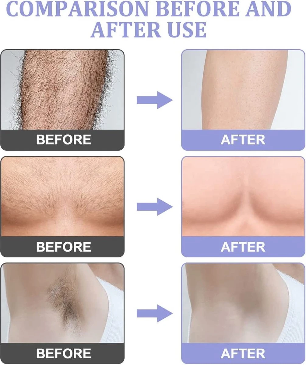 Livingful Premium Crystal Hair Removal • Pijnloos Ontharing Epileerapparaat Voor Armen Benen Rug• Mannen En Vrouwen • Epilator Voor Langdurige Ontharing • Snelle En Gemakkelijke Exfoliërende Ontharin • Haarverwijderaar • Kristalpad • Zijdezachte Huid 7 Livingful Premium Crystal Hair Removal • Pijnloos Ontharing Epileerapparaat Voor Armen Benen Rug• Mannen En Vrouwen • Epilator Voor Langdurige Ontharing • Snelle En Gemakkelijke Exfoliërende Ontharin • Haarverwijderaar • Kristalpad • Zijdezachte Huid - Afbeelding 5