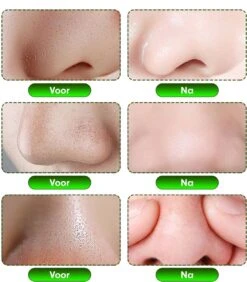 Aichun Beauty The Dead Sea Mud Peel Off Mask - Tegen Mee-Eters En Verstopte Poriën - Acne - Natuurlijk Product - 120ML -Lichaamsverzorging Winkel 1051x1200 3