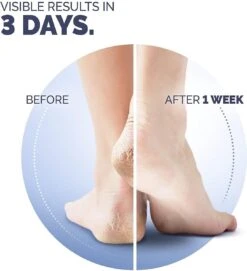 Scholl Klovenzalf - K+ Creme - Voor Hielkloven En Ruwe, Droge Huid 15 Scholl Klovenzalf - K+ Creme - Voor Hielkloven En Ruwe, Droge Huid -Lichaamsverzorging Winkel 1094x1200 1