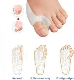 MYCARE+ Teencorrector - Wasbare Teencorrector - Gel-laag - 1 Paar - Pijn Verlichtend 13 MYCARE+ Teencorrector - Wasbare Teencorrector - Gel-laag - 1 Paar - Pijn Verlichtend -Lichaamsverzorging Winkel 1102x1200 2