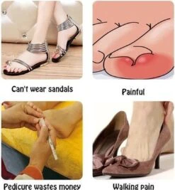 Merkloos Ingegroeide Teennagel Corrector -Lichaamsverzorging Winkel 1111x1200