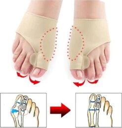 Hallux Valgus - Teenspreider - Teencorrector - Hallux Valgus Grote Teencorrector - Sok 2 Stuks