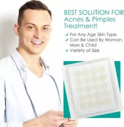 Pimple Patches - Acne Patches - Pimple Patch - Puisten Pleisters - Acne Pleister - 108 Stuks 11 Pimple Patches - Acne Patches - Pimple Patch - Puisten Pleisters - Acne Pleister - 108 Stuks -Lichaamsverzorging Winkel 1170x1200 1