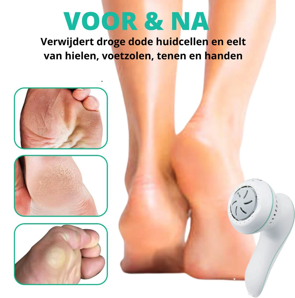 Forgoods Elektrische Eelt Verwijderaar Met Stofzuigsysteem - Eeltverwijderaar - USB Oplaadbaar - Krachtigste Motor Op De Markt - IPX7 Waterbestendig - Voetvijl - Inclusief Adapter - Extra 2 Sets Vijlschijven - Model 2023 4 Forgoods Elektrische Eelt Verwijderaar Met Stofzuigsysteem - Eeltverwijderaar - USB Oplaadbaar - Krachtigste Motor Op De Markt - IPX7 Waterbestendig - Voetvijl - Inclusief Adapter - Extra 2 Sets Vijlschijven - Model 2023 - Afbeelding 2