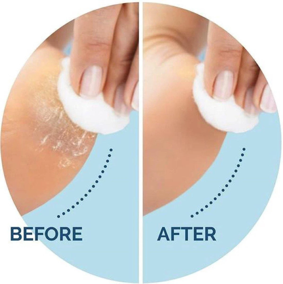 Scholl Velvet Smooth Voetvijl Wet & Dry - Starter - 1 Stuk 5 Scholl Velvet Smooth Voetvijl Wet & Dry - Starter - 1 Stuk - Afbeelding 3