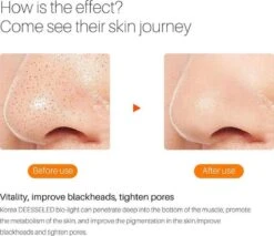 JTEX® - Professioneel LED Masker - Gezichtsmasker - Face Mask - Lichttherapie - 7 Soorten Behandelingen - Anti Rimpel - Anti Acne Huidverzorging - Skin Cleaner - Masker - Anti Aging Mask - Gezichtsbehandeling - New Generation - LED Masker 16 JTEX® - Professioneel LED Masker - Gezichtsmasker - Face Mask - Lichttherapie - 7 Soorten Behandelingen - Anti Rimpel - Anti Acne Huidverzorging - Skin Cleaner - Masker - Anti Aging Mask - Gezichtsbehandeling - New Generation - LED Masker -Lichaamsverzorging Winkel 1200x1035