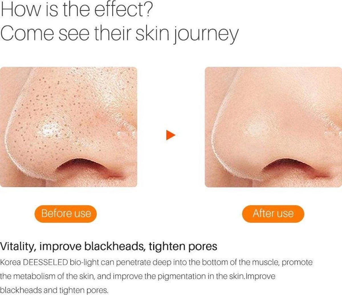 JTEX® - Professioneel LED Masker - Gezichtsmasker - Face Mask - Lichttherapie - 7 Soorten Behandelingen - Anti Rimpel - Anti Acne Huidverzorging - Skin Cleaner - Masker - Anti Aging Mask - Gezichtsbehandeling - New Generation - LED Masker 8 JTEX® - Professioneel LED Masker - Gezichtsmasker - Face Mask - Lichttherapie - 7 Soorten Behandelingen - Anti Rimpel - Anti Acne Huidverzorging - Skin Cleaner - Masker - Anti Aging Mask - Gezichtsbehandeling - New Generation - LED Masker - Afbeelding 6