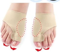 Merkloos Hallux Valgus Teen Spreider/Corrector Knobbel Teen Corrector |bunion | Eeltknobbel | Teen Rechtzetten | Comfortabel -Lichaamsverzorging Winkel 1200x1049