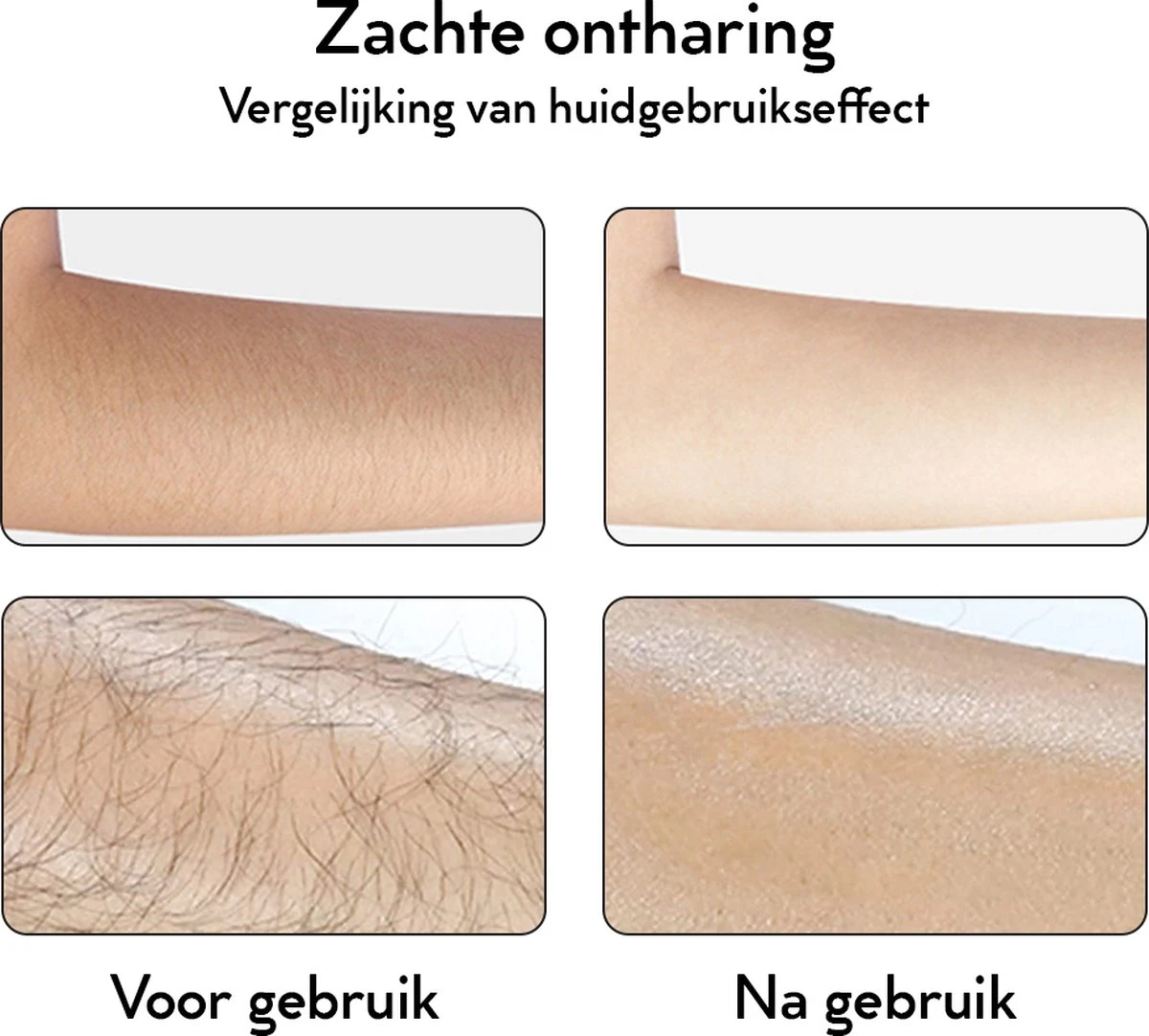 VRL Kristalpad - Crystal Ontharen - Haar Verwijderen - Ontharing - Pijnloos - Haarverwijderaar 8 VRL Kristalpad - Crystal Ontharen - Haar Verwijderen - Ontharing - Pijnloos - Haarverwijderaar - Afbeelding 6