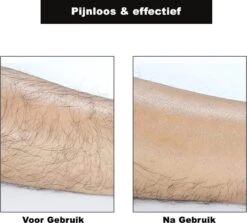 Crystal Hair Removal - Crystal Hair Eraser - Bleame - Kristalpad - Ontharing - Pijnloos - TikTok - Crystal Hair Remover - Haarverwijderaar 13 Crystal Hair Removal - Crystal Hair Eraser - Bleame - Kristalpad - Ontharing - Pijnloos - TikTok - Crystal Hair Remover - Haarverwijderaar -Lichaamsverzorging Winkel 1200x1082 4