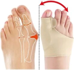 Hallux Valgus - Teenspreider - Teencorrector - Hallux Valgus Grote Teencorrector - Sok 2 Stuks -Lichaamsverzorging Winkel 1200x1133