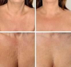 Simia™ Anti Rimpel Beauty Pads - Decolleté Large T Shape Set (2 Stuks) - Herbruikbaar Anti Aging Siliconen Pad Tegen Lijntjes En Slaaprimpels 11 Simia™ Anti Rimpel Beauty Pads - Decolleté Large T Shape Set (2 Stuks) - Herbruikbaar Anti Aging Siliconen Pad Tegen Lijntjes En Slaaprimpels -Lichaamsverzorging Winkel 1200x1139 6