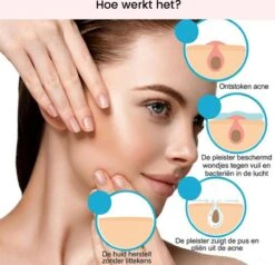 Acne Patches (108x) Met Blackhead Remover Set - Puisten Pleister - Puisten Verwijderaar - 108 Pleisters In 2 Formaten - Mee Eters Verwijderen - Pimple Patch Voor Acneverzorging Met Comedonenlepel Set - Acne Stickers 9 Acne Patches (108x) Met Blackhead Remover Set - Puisten Pleister - Puisten Verwijderaar - 108 Pleisters In 2 Formaten - Mee Eters Verwijderen - Pimple Patch Voor Acneverzorging Met Comedonenlepel Set - Acne Stickers -Lichaamsverzorging Winkel 1200x1158 2