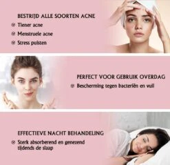 Acne Patches Voor Dag En Nacht - Puisten Verwijderaar - Huidreiniger - 144 Stuks In 2 Formaten - Pukkel Pleister - Pimple Patch Die Onzuiverheden Absorbeert - Acneverzorging 13 Acne Patches Voor Dag En Nacht - Puisten Verwijderaar - Huidreiniger - 144 Stuks In 2 Formaten - Pukkel Pleister - Pimple Patch Die Onzuiverheden Absorbeert - Acneverzorging -Lichaamsverzorging Winkel 1200x1162 2