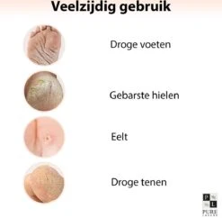 PureLuxure Voetmasker - Voetverzorging - Eeltsokken - Eelt Verwijderaar - Voetenmasker - Peel Off Masker - 1 Paar (2 Stuks) 18 PureLuxure Voetmasker - Voetverzorging - Eeltsokken - Eelt Verwijderaar - Voetenmasker - Peel Off Masker - 1 Paar (2 Stuks) -Lichaamsverzorging Winkel 1200x1174 1