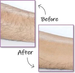 EPC® Duo Crystal Hair Removal Pad - Ontharings Pad - Pijnloos Ontharen - Kristal Haarverwijderaar - Scrubi - Ontharing Eraser Kristalpad - Bleame - Armen Benen Bikinilijn - Roze 9 EPC® Duo Crystal Hair Removal Pad - Ontharings Pad - Pijnloos Ontharen - Kristal Haarverwijderaar - Scrubi - Ontharing Eraser Kristalpad - Bleame - Armen Benen Bikinilijn - Roze -Lichaamsverzorging Winkel 1200x1177 4