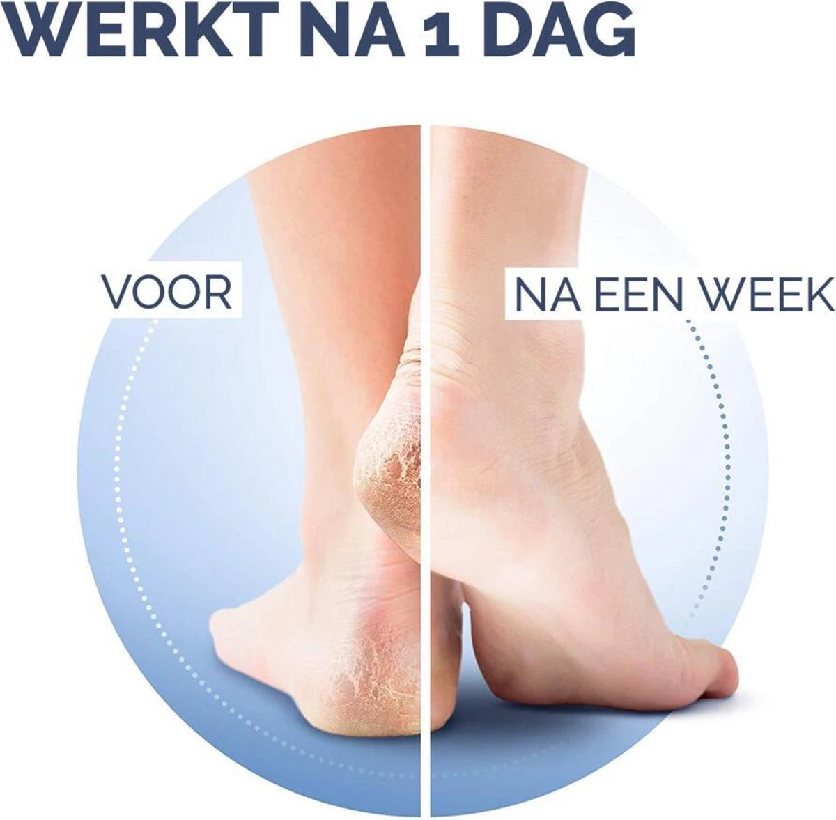 Scholl Klovenzalf - K+ Creme - Voor Hielkloven En Ruwe, Droge Huid 6 Scholl Klovenzalf - K+ Creme - Voor Hielkloven En Ruwe, Droge Huid - Afbeelding 4
