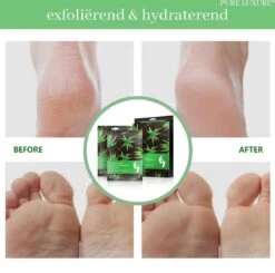 PureLuxure Voetmasker - Voetverzorging - Eeltsokken - Eelt Verwijderaar - Voetenmasker - Peel Off Masker - 1 Paar (2 Stuks) 15 PureLuxure Voetmasker - Voetverzorging - Eeltsokken - Eelt Verwijderaar - Voetenmasker - Peel Off Masker - 1 Paar (2 Stuks) -Lichaamsverzorging Winkel 1200x1191 1