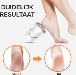 MW® Elektrische Eeltverwijderaar - Voetvijl - Eelt Verwijderaar - Elektrische Vijl - 3 Vijlschijven 13 MW® Elektrische Eeltverwijderaar - Voetvijl - Eelt Verwijderaar - Elektrische Vijl - 3 Vijlschijven -Lichaamsverzorging Winkel 1200x1191 2