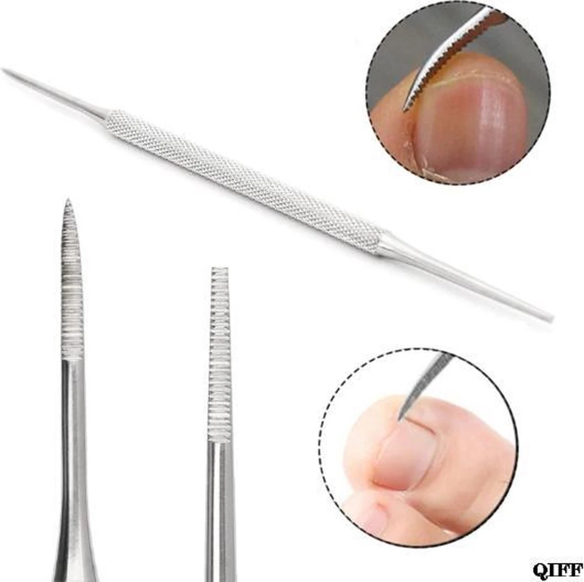 Merkloos Teennagel Vijl- Nagel Lifter - Ingegroeid - Vuil - Kalknagel - Verzorging - RVS - 1 Stuk 3 Merkloos Teennagel Vijl- Nagel Lifter - Ingegroeid - Vuil - Kalknagel - Verzorging - RVS - 1 Stuk