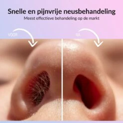 Rivema Luxe Wax Ontharing Set – Neus Ontharing – Wax Beans – Ontharingswax – Ontharen – 7 Maanden Haarvrij 13 Rivema Luxe Wax Ontharing Set – Neus Ontharing – Wax Beans – Ontharingswax – Ontharen – 7 Maanden Haarvrij -Lichaamsverzorging Winkel 1200x1200 1321