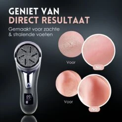 Beeperfect® Elektrische Eeltverwijderaar Met Stofzuigsysteem - Voetvijl - Eeltvijl - IPX7 Waterdicht - Gratis Pedicure Set - Zwart 16 Beeperfect® Elektrische Eeltverwijderaar Met Stofzuigsysteem - Voetvijl - Eeltvijl - IPX7 Waterdicht - Gratis Pedicure Set - Zwart -Lichaamsverzorging Winkel 1200x1200 163