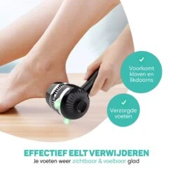 Vulpes BeautyCare® Elektrische Eelt Verwijderaar Pro – Stofzuigfunctie – 3 Snelheden – Inclusief 3 Vijlschijven & Borstel - USB-Oplaadbaar 16 Vulpes BeautyCare® Elektrische Eelt Verwijderaar Pro – Stofzuigfunctie – 3 Snelheden – Inclusief 3 Vijlschijven & Borstel - USB-Oplaadbaar -Lichaamsverzorging Winkel 1200x1200 179