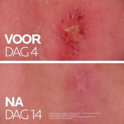 La Roche-Posay Cicaplast Balsem B5+ - 40ml - Voor Gevoelige Huid - Helpt De Huid Herstellen -Lichaamsverzorging Winkel 1200x1200 2225