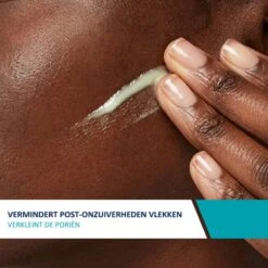 CeraVe Resurfacing Retinol Serum - 30ml - Voor Onzuivere Huid Met Neiging Tot Acne -Lichaamsverzorging Winkel 1200x1200 2237