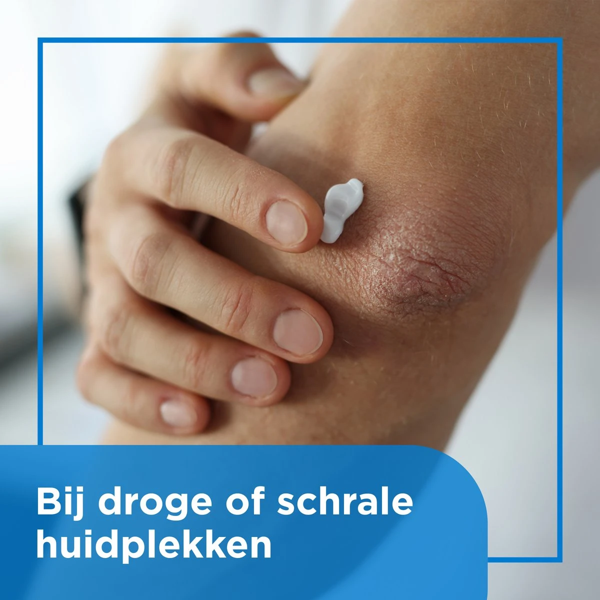 Bepanthen Beschermende Zalf - Intensief Vettende Zalf - Zonder Parfum - Droge Of Schrale Huidplekken - 50 Gram 6 Bepanthen Beschermende Zalf - Intensief Vettende Zalf - Zonder Parfum - Droge Of Schrale Huidplekken - 50 Gram - Afbeelding 4