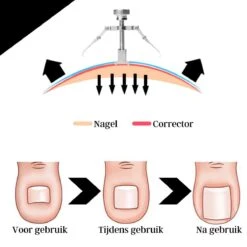 7-delige Pedicure En Manicure Set - Nagelknipper - Pedicureset - Nagelvijl - Nageltang - Kalknagel - Teennagelknipper -Lichaamsverzorging Winkel 1200x1200 247