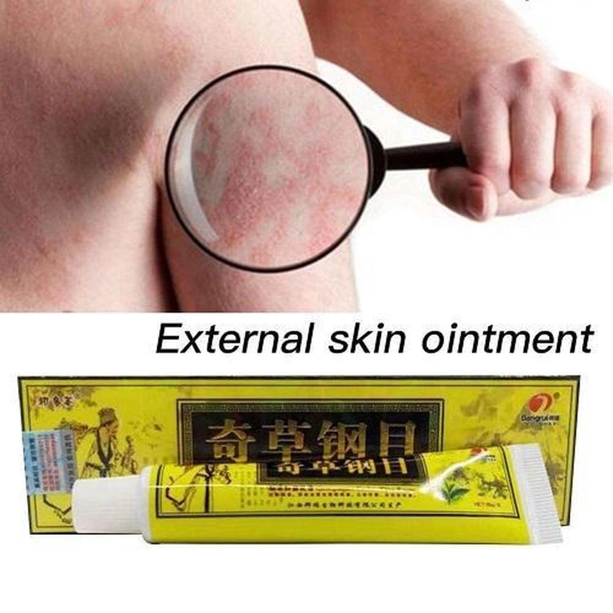 Psoriasis/exzeem Chineese Creme 7 Psoriasis/exzeem Chineese Creme - Afbeelding 5