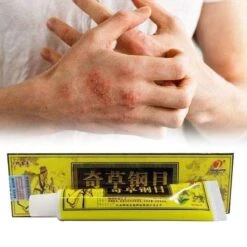 Psoriasis/exzeem Chineese Creme 17 Psoriasis/exzeem Chineese Creme -Lichaamsverzorging Winkel 1200x1200 2509