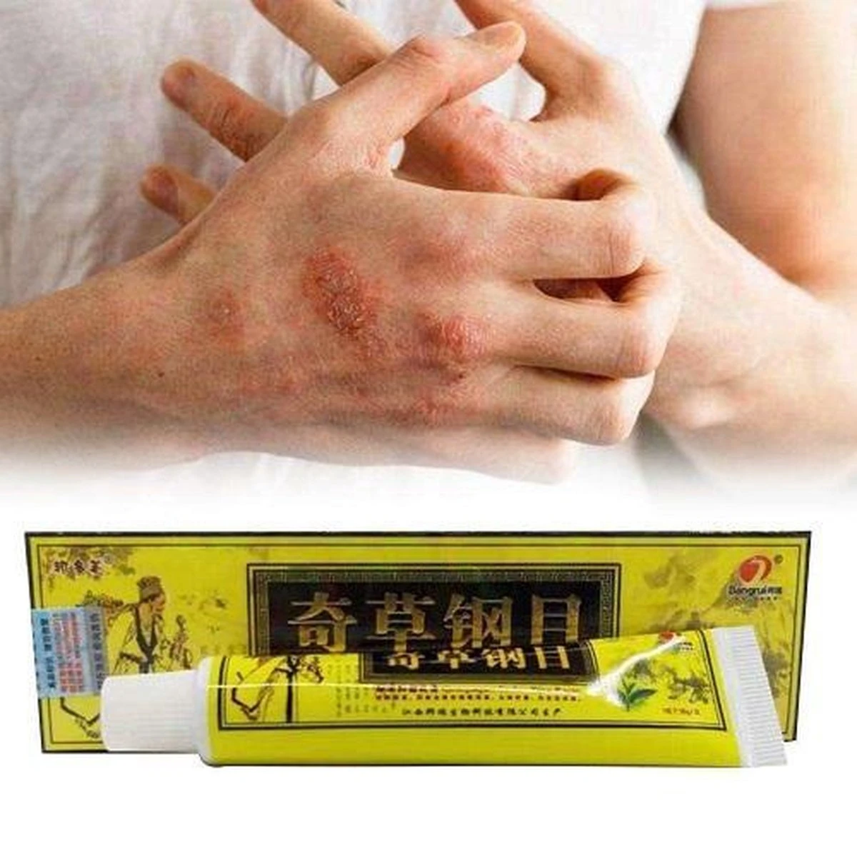 Psoriasis/exzeem Chineese Creme 8 Psoriasis/exzeem Chineese Creme - Afbeelding 6