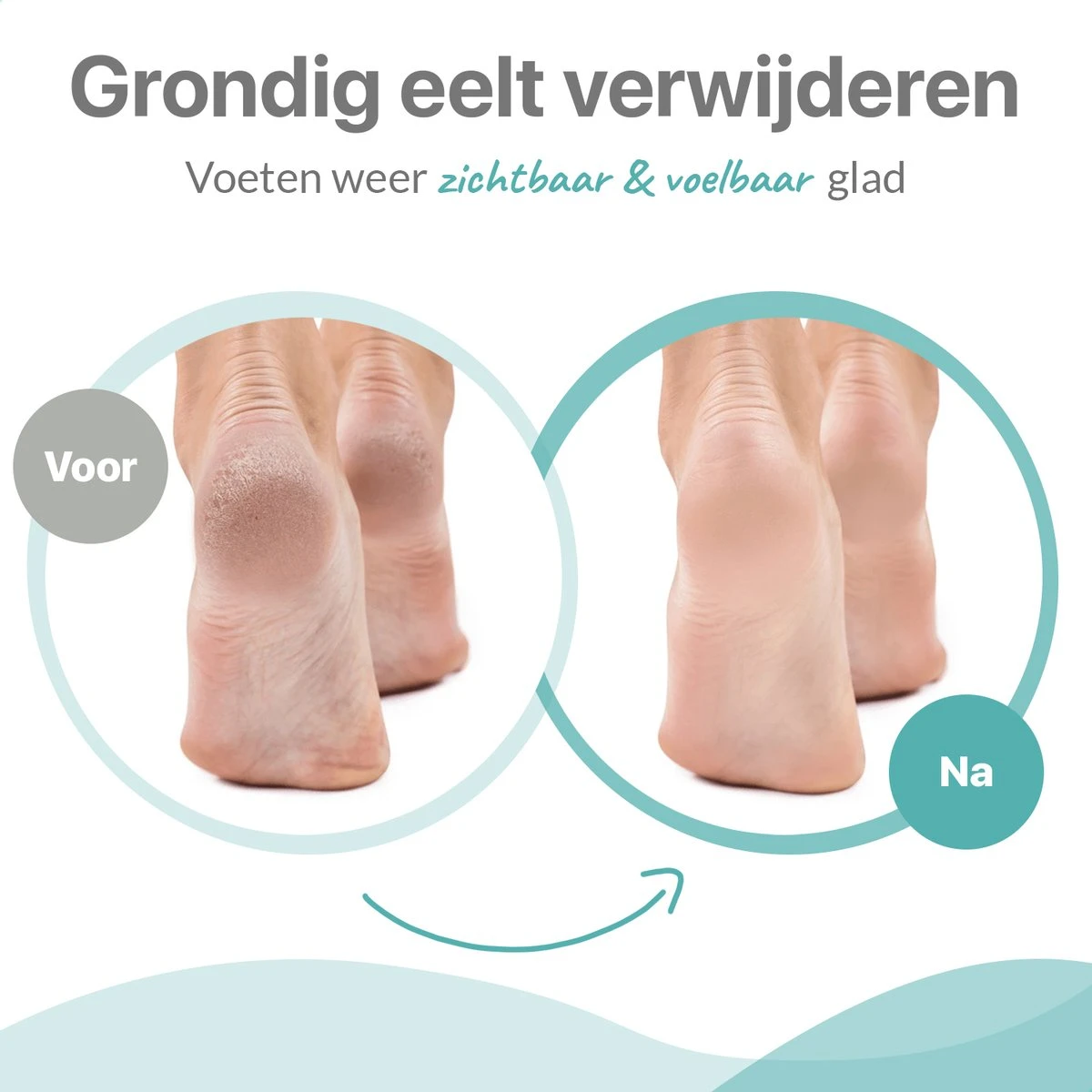 Be Lavish Elektrische Eeltverwijderaar Met Stofzuigsysteem - Voetvijl - Eeltvijl - IPX7 Waterdicht - USB Oplaadbaar - Inc. 3 Opzetstukken & Borstel 7 Be Lavish Elektrische Eeltverwijderaar Met Stofzuigsysteem - Voetvijl - Eeltvijl - IPX7 Waterdicht - USB Oplaadbaar - Inc. 3 Opzetstukken & Borstel - Afbeelding 5