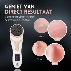 Beeperfect® Elektrische Eeltverwijderaar Met Stofzuigsysteem - Voetvijl - Eeltvijl - IPX7 Waterdicht - Gratis Pedicure Set -Lichaamsverzorging Winkel 1200x1200 340