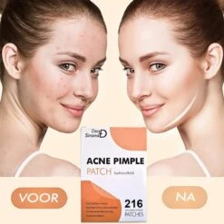 Dea Sirona Pimple Patch - Acne Patch - Puisten Verwijderaar - Puisten Pleister - Acne Pleister - Acne Sticker - Puistjes Verwijderen - 216 Stuks -Lichaamsverzorging Winkel 1200x1200 399