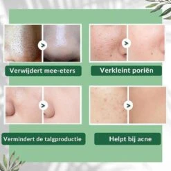 MENGSIQI - Green Mask Stick - Huidverzorging - Gezichtsmasker - Kleimasker - Mee Eters & Acne Verwijderen - Acne Verzorging - Vette Huid - Mee-eter Verwijderaar - Poriën Reiniger -Blackhead - Unisex - Verzachtend -Verkoelend - Dermatologisch Getest -Lichaamsverzorging Winkel 1200x1200 540