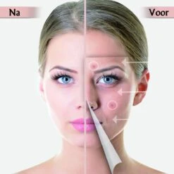 Acne Patches Voor Dag En Nacht - Puisten Verwijderaar - Huidreiniger - 144 Stuks In 2 Formaten - Pukkel Pleister - Pimple Patch Die Onzuiverheden Absorbeert - Acneverzorging 14 Acne Patches Voor Dag En Nacht - Puisten Verwijderaar - Huidreiniger - 144 Stuks In 2 Formaten - Pukkel Pleister - Pimple Patch Die Onzuiverheden Absorbeert - Acneverzorging -Lichaamsverzorging Winkel 1200x1200 584