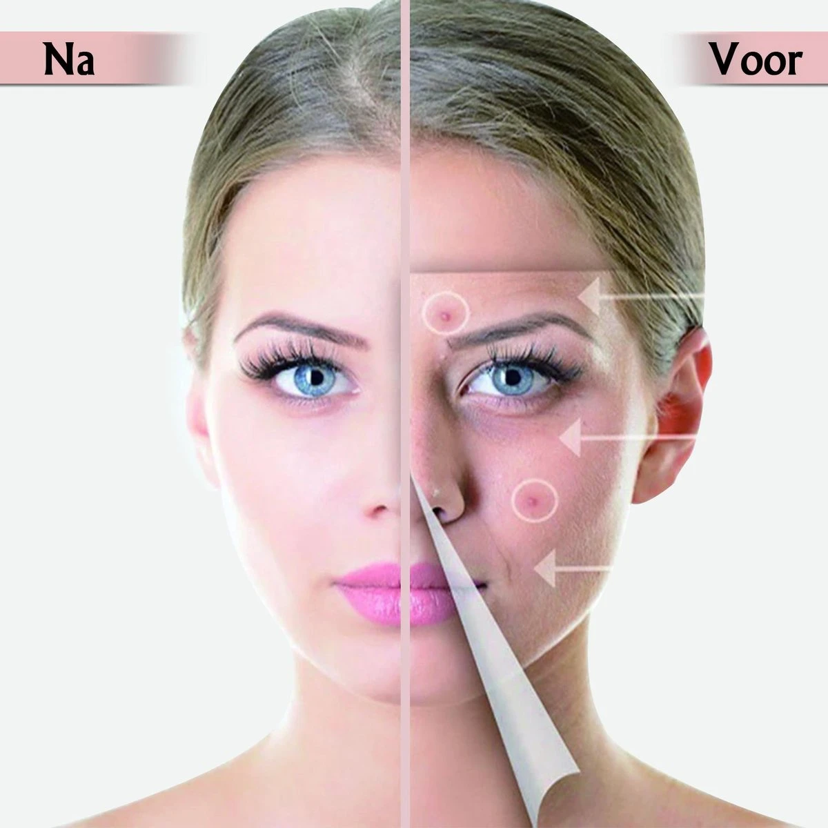 Acne Patches Voor Dag En Nacht - Puisten Verwijderaar - Huidreiniger - 144 Stuks In 2 Formaten - Pukkel Pleister - Pimple Patch Die Onzuiverheden Absorbeert - Acneverzorging 8 Acne Patches Voor Dag En Nacht - Puisten Verwijderaar - Huidreiniger - 144 Stuks In 2 Formaten - Pukkel Pleister - Pimple Patch Die Onzuiverheden Absorbeert - Acneverzorging - Afbeelding 6