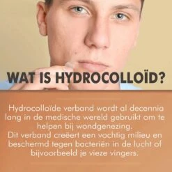 Palm Cosmetics® Pimple Patch - Acne Patch - Puisten Verwijderaar - Puisten Pleister - Acne Pleister - Acne Sticker - Puistjes Verwijderen - 108 Stuks -Lichaamsverzorging Winkel 1200x1200 668