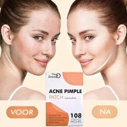 Dea Sirona Pimple Patch - Acne Patch - Puisten Verwijderaar - Puisten Pleister - Acne Pleister - Acne Sticker - Puistjes Verwijderen - 108 Stuks -Lichaamsverzorging Winkel 1200x1200 683