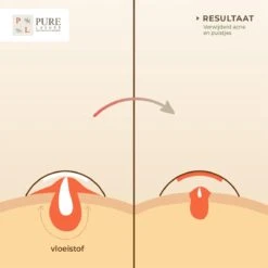 Pimple Patch 144 ST - Acne Patch - Acne - Acne Pleister - Pimple Patches - Puisten Verwijderaar 17 Pimple Patch 144 ST - Acne Patch - Acne - Acne Pleister - Pimple Patches - Puisten Verwijderaar -Lichaamsverzorging Winkel 1200x1200 724