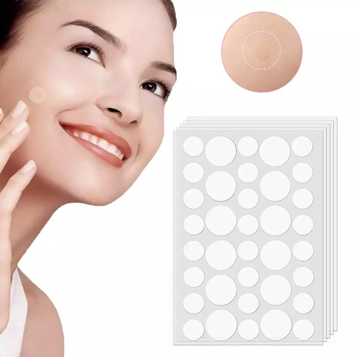 Pimple Patches - Acne Patches - Pimple Patch - Puisten Pleisters - Acne Pleister - 108 Stuks 4 Pimple Patches - Acne Patches - Pimple Patch - Puisten Pleisters - Acne Pleister - 108 Stuks - Afbeelding 2