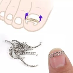 Nagelbeugeltjes Ingegroeide Nagel - Ingegroeide Teennagel - Teennagel Corrector - Nagelbeugel - Set 6 Stuks