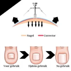 7-Delige Pedicure Set - Nagelverzorging - Nagelset - Ingegroeide Teennagel - Nagelknipper - Nail Clippers - Ingrown Toenail 27 7-Delige Pedicure Set - Nagelverzorging - Nagelset - Ingegroeide Teennagel - Nagelknipper - Nail Clippers - Ingrown Toenail -Lichaamsverzorging Winkel 1200x1200 92