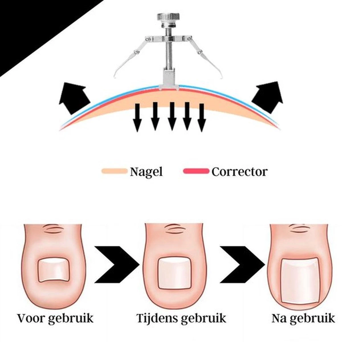 7-Delige Pedicure Set - Nagelverzorging - Nagelset - Ingegroeide Teennagel - Nagelknipper - Nail Clippers - Ingrown Toenail 14 7-Delige Pedicure Set - Nagelverzorging - Nagelset - Ingegroeide Teennagel - Nagelknipper - Nail Clippers - Ingrown Toenail - Afbeelding 12