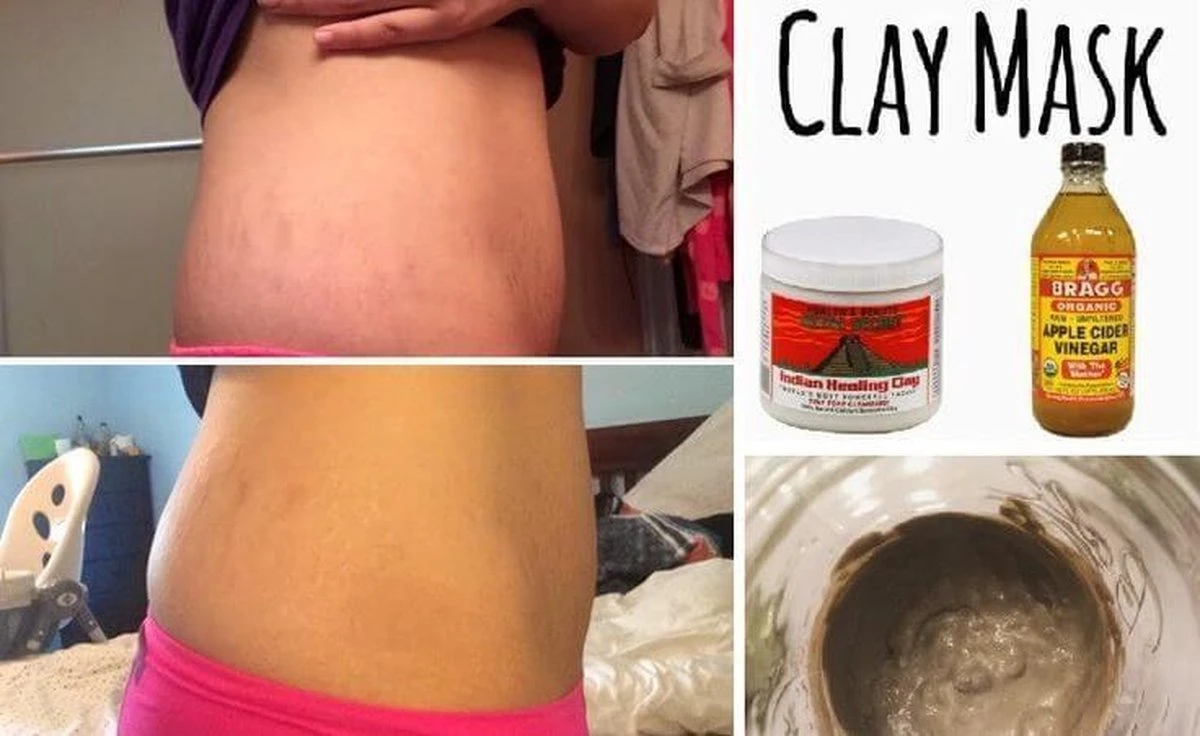 Aztec Secret Indian Healing Clay Gezichtsmasker - 454 G - 100% Natuurlijke Betonine Clay - New Formula 4 Aztec Secret Indian Healing Clay Gezichtsmasker - 454 G - 100% Natuurlijke Betonine Clay - New Formula - Afbeelding 2