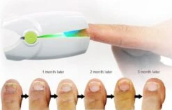 Anti Schimmelnagel Kalknagel Laserapparaat Om Zelf Te Behandelen, Veilig, Effectief, Snel En Pijnloos, Koude Laser Behandeling Voor Thuisgebruik, Voor Tenen En Vingers. Oplaadbaar. 12 Anti Schimmelnagel Kalknagel Laserapparaat Om Zelf Te Behandelen, Veilig, Effectief, Snel En Pijnloos, Koude Laser Behandeling Voor Thuisgebruik, Voor Tenen En Vingers. Oplaadbaar. -Lichaamsverzorging Winkel 1200x774