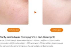 JTEX® - Professioneel LED Masker - Gezichtsmasker - Face Mask - Lichttherapie - 7 Soorten Behandelingen - Anti Rimpel - Anti Acne Huidverzorging - Skin Cleaner - Masker - Anti Aging Mask - Gezichtsbehandeling - New Generation - LED Masker 15 JTEX® - Professioneel LED Masker - Gezichtsmasker - Face Mask - Lichttherapie - 7 Soorten Behandelingen - Anti Rimpel - Anti Acne Huidverzorging - Skin Cleaner - Masker - Anti Aging Mask - Gezichtsbehandeling - New Generation - LED Masker -Lichaamsverzorging Winkel 1200x808 2